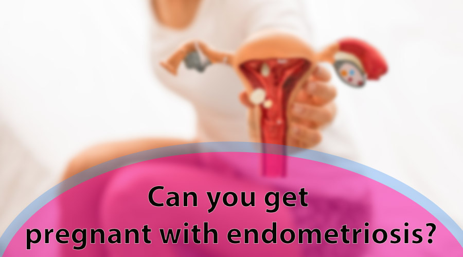 Can you get pregnant with endometriosis?