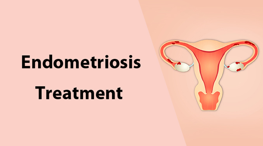increased risk in women with endometriosis symptoms