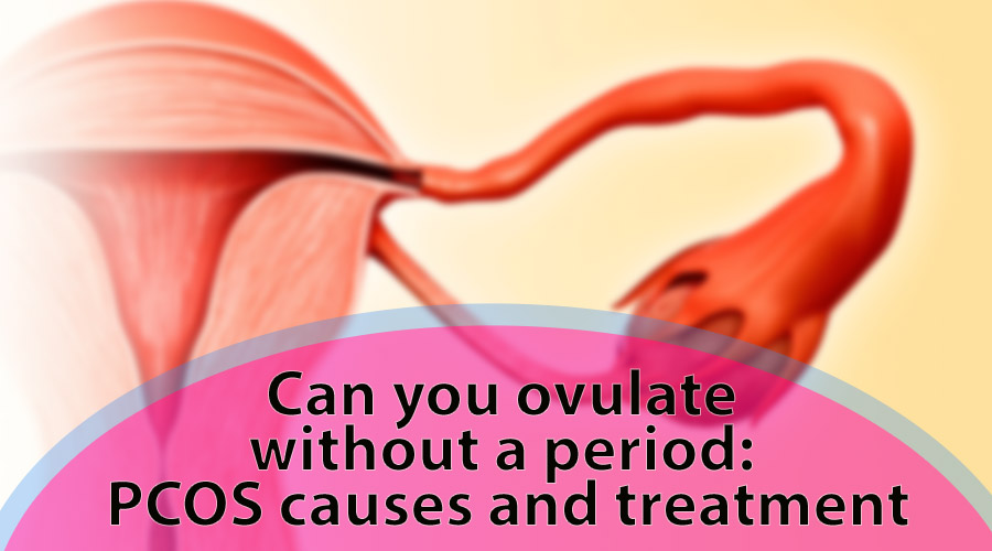 Can you ovulate without a period: PCOS causes and treatment